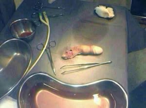 03abr14-mulher-presa-penis.3