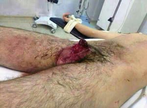 03abr14-mulher-presa-penis.4